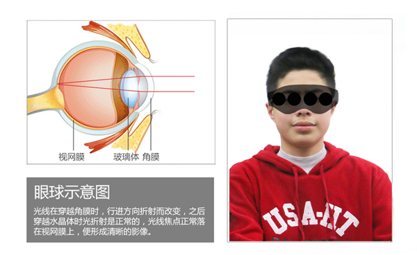 学生近视护眼仪